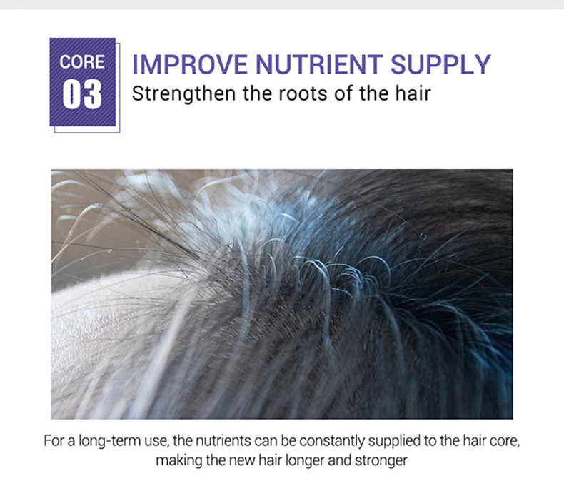 Title: How to Deal with Down Comforter Hair Loss?