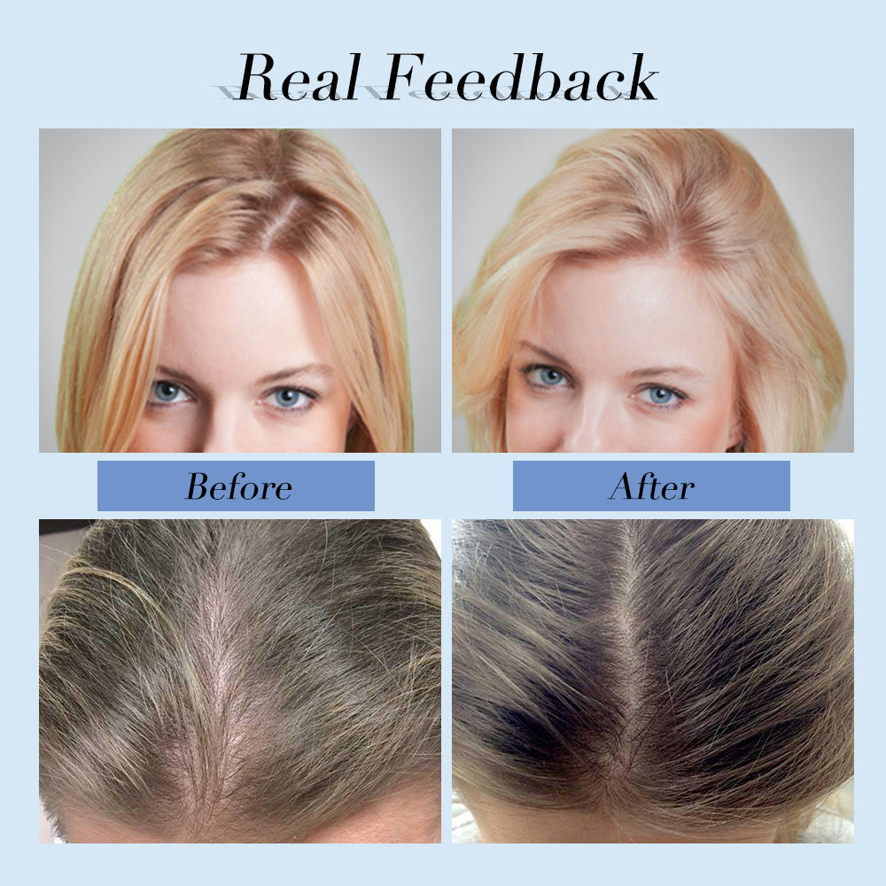 Title: How to Deal with Down Comforter Hair Loss?